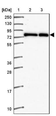 Western Blot: ZNF778 Antibody [NBP2-33637] - Lane 1: Marker [kDa] 250, 130, 95, 72, 55, 36, 28, 17, 10Lane 2: Human cell line RT-4Lane 3: Human cell line U-251MG sp