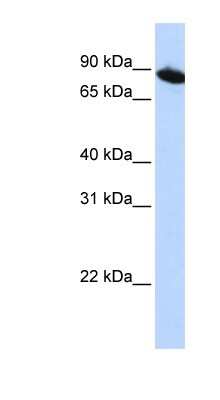 Western Blot: ZNF780A Antibody [NBP1-79357] - HepG2 cell lysate, concentration 0.2-1 ug/ml.