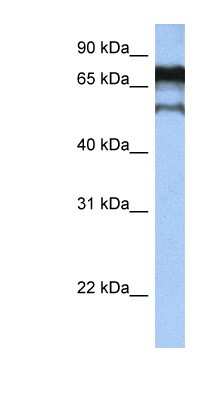 Western Blot: ZNF780B Antibody [NBP1-79348] - Hela cell lysate, concentration 0.2-1 ug/ml.