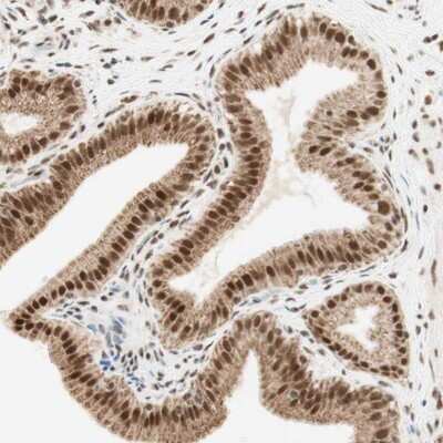 Immunohistochemistry-Paraffin ZNF782 Antibody - BSA Free