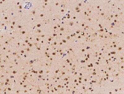 Immunohistochemistry-Paraffin ZNF782 Antibody - BSA Free