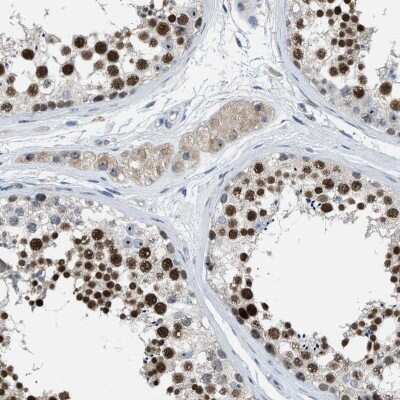 Immunohistochemistry-Paraffin: ZNF783 Antibody [NBP1-85058] - Staining of human testis shows strong nuclear positivity in cells of the seminiferous ducts.
