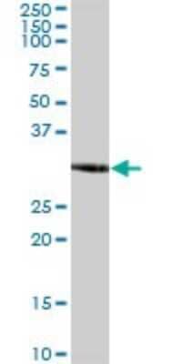 Western Blot: ZNF783 Antibody [H00155060-B01P] - Analysis of LOC155060 expression in rat brain.