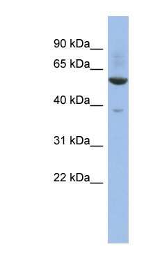 Western Blot: ZNF783 Antibody [NBP1-79346] - THP-1 cell lysate, concentration 0.2-1 ug/ml.