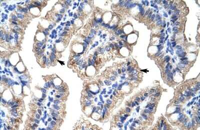 Immunohistochemistry ZNF785 Antibody - BSA Free