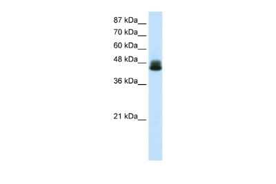 Western Blot: ZNF785 Antibody [NBP2-83907] - WB Suggested Anti-ZNF785 Antibody Titration: 0.2-1 ug/ml. ELISA Titer: 1:62500. Positive Control: Transfected 293T