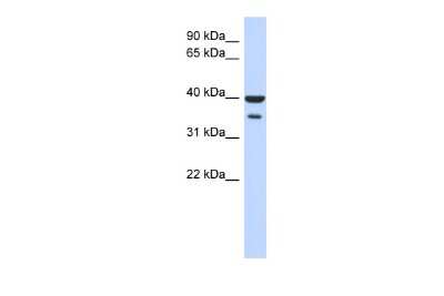 Western Blot: ZNF785 Antibody [NBP2-83909] - WB Suggested Anti-ZNF785 Antibody Titration: 0.2-1 ug/ml. ELISA Titer: 1:62500. Positive Control: Human Pancreas