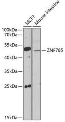 Western Blot: ZNF785 Antibody [NBP2-93647] - Analysis of extracts of various cell lines, using ZNF785 at 1:1000 dilution. Secondary antibody: HRP Goat Anti-Rabbit IgG (H+L) at 1:10000 dilution. Lysates/proteins: 25ug per lane. Blocking buffer: 3% nonfat dry milk in TBST. Detection: ECL Basic Kit . Exposure time: 90s.