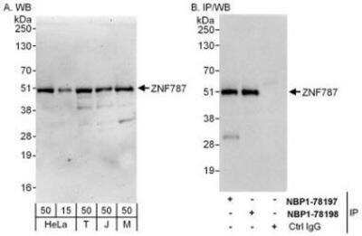 Western Blot ZNF787 Antibody