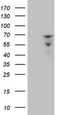 Western Blot ZNF79 Antibody (OTI3D2)