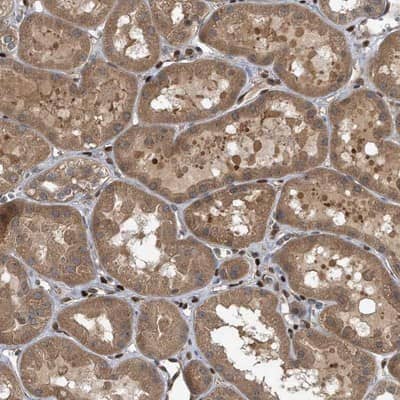 Immunohistochemistry-Paraffin: ZNF79 Antibody [NBP1-80872] - Staining of human kidney shows moderate cytoplasmic positivity in renal tubule cells.