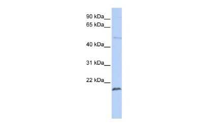 Western Blot: ZNF79 Antibody [NBP2-88744] - WB Suggested Anti-ZNF79 Antibody Titration: 0.2-1 ug/ml. ELISA Titer: 1:1562500. Positive Control: Jurkat cell lysate