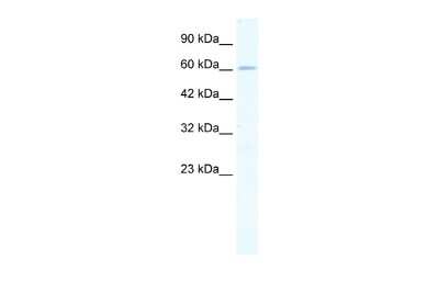 Western Blot: ZNF79 Antibody [NBP2-88745] - WB Suggested Anti-ZNF79 Antibody. Titration: 0.25 ug/ml. Positive Control: Jurkat Whole Cell