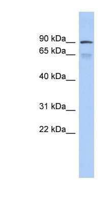 Western Blot: ZNF791 Antibody [NBP1-80178] - Human Thymus lysate, concentration 0.2-1 ug/ml.