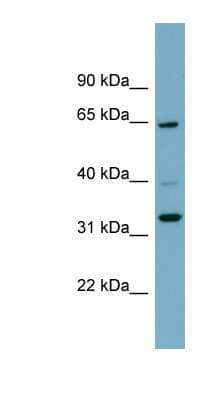 Western Blot: ZNF791 Antibody [NBP1-80426] - Human Spleen lysate, concentration 0.2-1 ug/ml.