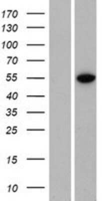 Western Blot: ZNF791 Overexpression Lysate (Adult Normal) [NBP2-05260] Left-Empty vector transfected control cell lysate (HEK293 cell lysate); Right -Over-expression Lysate for ZNF791.