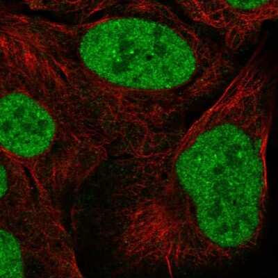 Immunocytochemistry/ Immunofluorescence ZNF792 Antibody - BSA Free