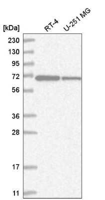Western Blot ZNF792 Antibody - BSA Free