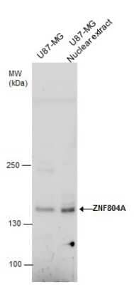 Western Blot ZNF804A Antibody