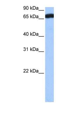 Western Blot: ZNF806 Antibody [NBP1-91404] - Human Brain lysate, concentration 0.2-1 ug/ml.