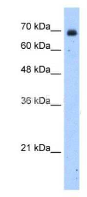 Western Blot: ZNF823 Antibody [NBP1-91372] - Jurkat cell lysate, concentration 2.5 ug/ml.