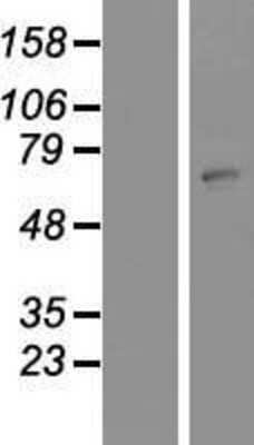 Western Blot ZNF823 Overexpression Lysate