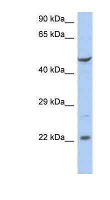 Western Blot: ZNF826P Antibody [NBP1-91369] - Titration: 0.2-1 ug/ml, Positive Control: PANC1 cell lysate.
