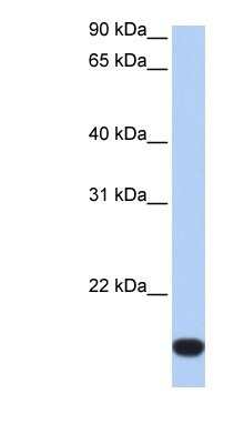 Western Blot: ZNF826P Antibody [NBP1-91370] - Human Liver cell lysate, concentration 0.2-1 ug/ml.