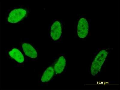 Immunocytochemistry/Immunofluorescence: ZNF828 Antibody [H00283489-B01P] - Analysis of purified antibody to C13orf8 on HeLa cell. (antibody concentration 10 ug/ml)