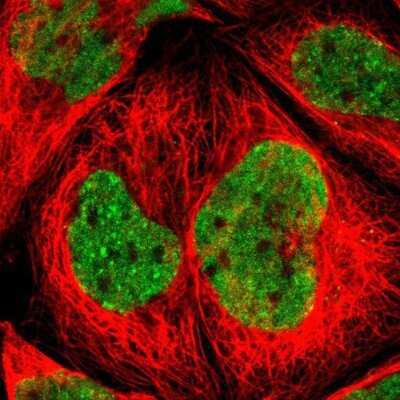 Immunocytochemistry/Immunofluorescence: ZNF828 Antibody [NBP1-88403] - Staining of human cell line A-431 shows positivity in nuclei but not nucleoli.