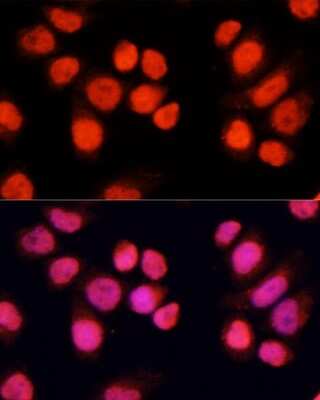 Immunocytochemistry/Immunofluorescence: ZNF828 Antibody [NBP2-93670] - Analysis of Hela cells using ZNF828 . Blue: DAPI for nuclear staining.