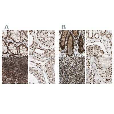 Immunohistochemistry-Paraffin: ZNF828 Antibody [NBP1-88402] - Staining of human colon, kidney, lymph node and testis using Anti-CHAMP1 antibody NBP1-88402 (A) shows similar protein distribution across tissues to independent antibody NBP1-88403 (B).