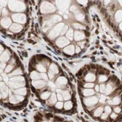 Immunohistochemistry-Paraffin: ZNF828 Antibody [NBP1-88402] - Staining of human colon.