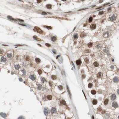 Immunohistochemistry-Paraffin: ZNF828 Antibody [NBP1-88402] - Staining of human testis.