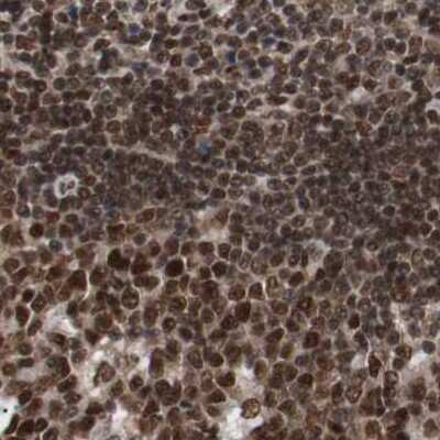 Immunohistochemistry-Paraffin: ZNF828 Antibody [NBP1-88402] - Staining of human lymph node.