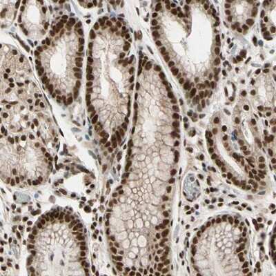 Immunohistochemistry-Paraffin: ZNF828 Antibody [NBP1-88403] - Staining of human stomach shows strong nuclear positivity in glandular cells.