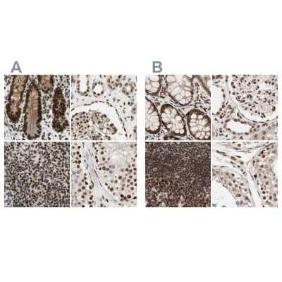 <b>Independent Antibodies Validation. </b>Immunohistochemistry-Paraffin: ZNF828 Antibody [NBP1-88403] - Staining of human colon, kidney, lymph node and testis using Anti-CHAMP1 antibody NBP1-88403 (A) shows similar protein distribution across tissues to independent antibody NBP1-88402 (B).