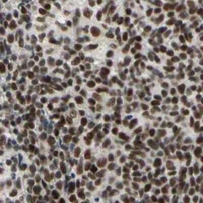 Immunohistochemistry-Paraffin: ZNF828 Antibody [NBP1-88403] - Staining of human lymph node.