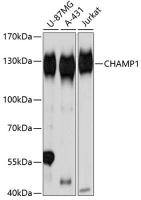 Western Blot: ZNF828 Antibody [NBP2-93670] - Analysis of extracts of various cell lines, using ZNF828 at 1:3000 dilution.Secondary antibody: HRP Goat Anti-Rabbit IgG (H+L) at 1:10000 dilution.Lysates/proteins: 25ug per lane.Blocking buffer: 3% nonfat dry milk in TBST.Detection: ECL Basic Kit .Exposure time: 1s.