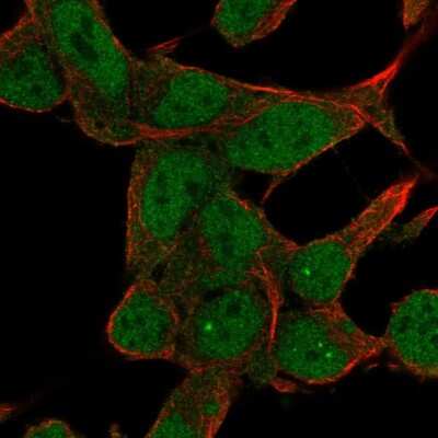 Immunocytochemistry/ Immunofluorescence ZNF829 Antibody - BSA Free