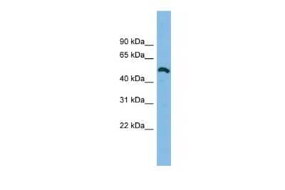 Western Blot ZNF829 Antibody - BSA Free