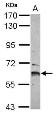 Western Blot: ZNF83 Antibody [NBP2-21049] - Sample (30 ug of whole cell lysate) A: IMR32 7. 5% SDS PAGE gel, diluted at 1:1000.
