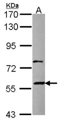 Western Blot ZNF83 Antibody - BSA Free