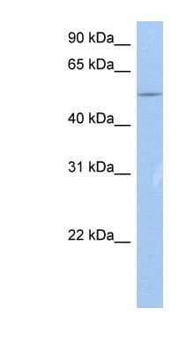 Western Blot: ZNF835 Antibody [NBP1-79347] - MCF-7 whole cell lysates, concentration 0.2-1 ug/ml.