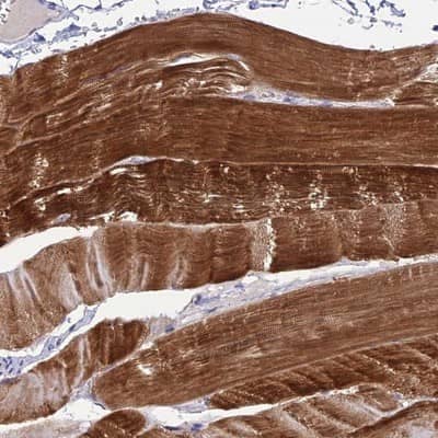 Immunohistochemistry-Paraffin: ZNF837 Antibody [NBP1-90888] - Staining of human skeletal muscle shows strong cytoplasmic positivity in myocytes.