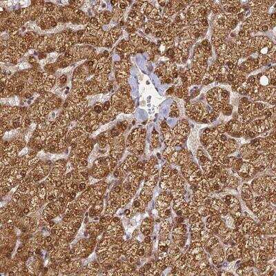 Immunohistochemistry ZNF443 Antibody - BSA Free