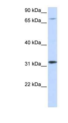 Western Blot: ZNF842 Antibody [NBP1-80202] - 293T cells lysate, concentration 0.2-1 ug/ml.