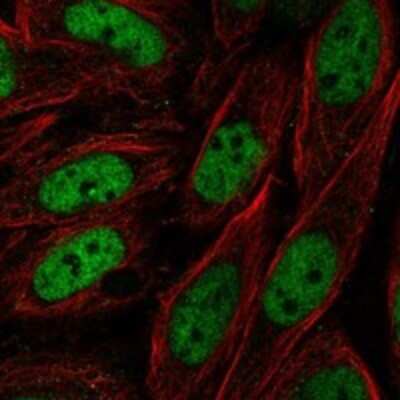 Immunocytochemistry/ Immunofluorescence ZNF843 Antibody - BSA Free