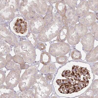 Immunohistochemistry ZNF843 Antibody - BSA Free