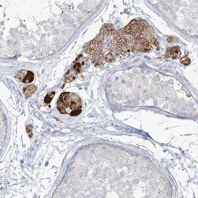 Immunohistochemistry-Paraffin: ZNF843 Antibody [NBP1-93468] - Staining of human testis shows strong cytoplasmic positivity in Leydig cells.